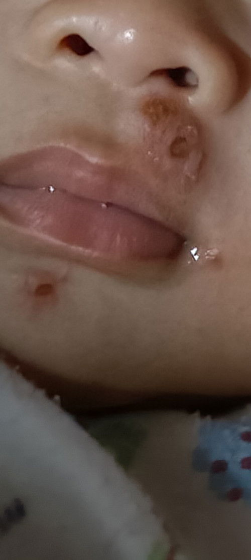 Ada yg tau kira² nama penyakit dan nama obat nya ??