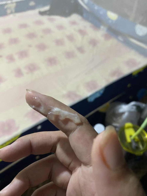 38วีคมีอะไรออกมาจากช่องคลอด