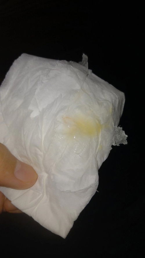 Maaf ,ini tanda melahirkan atau sekedar flek yaa