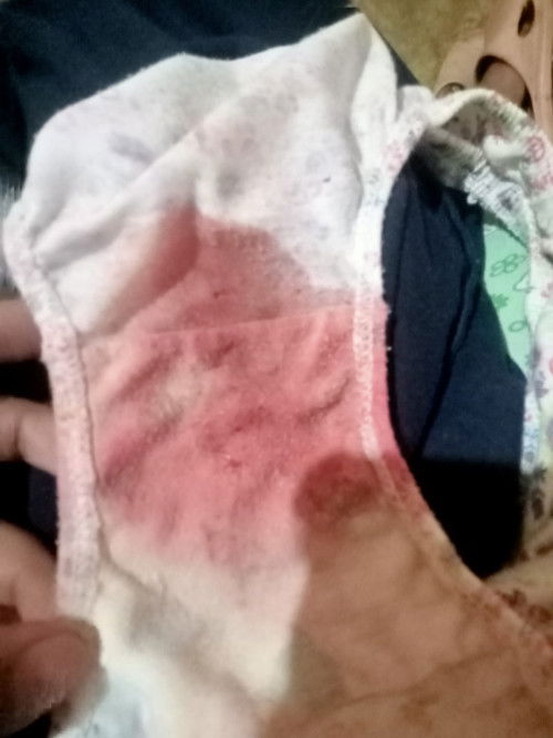 Dlawang kunan napo una di po naraspa ngyn pangalwa narasapa may chance papo bang mag kababy