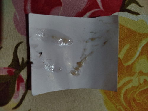 Ini keputihan agak kuning/flek Bun ,saya hamil 9 Minggu
Soalnya gatal jg