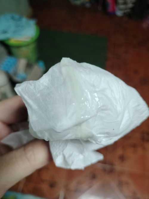 สอบถามแม่ๆ ตอนนี้38w 4d