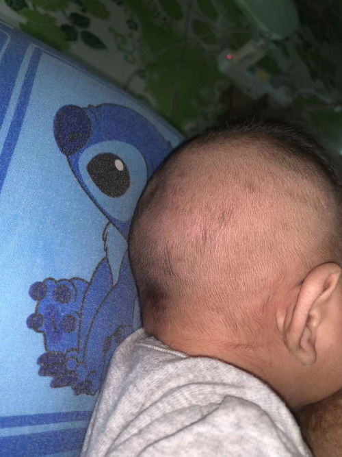 กระหม่อนส่วนหลังยังปิดไม่สนิท
