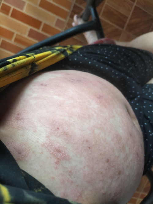 แม่ๆบ้านไหนมีใครเป็นแบบนี้บ้างคะ