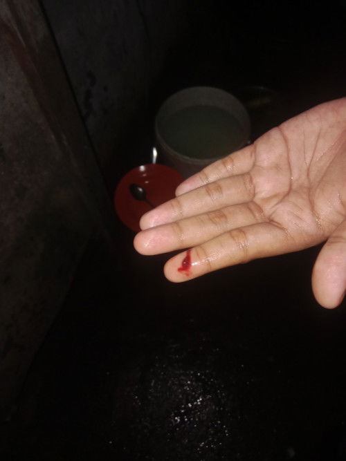 Usia kehamilan 35minggu 2hari