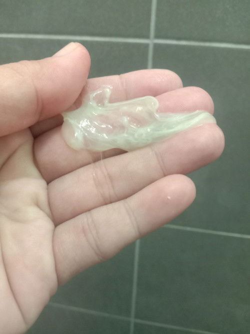 Mucus plug atau keputihan