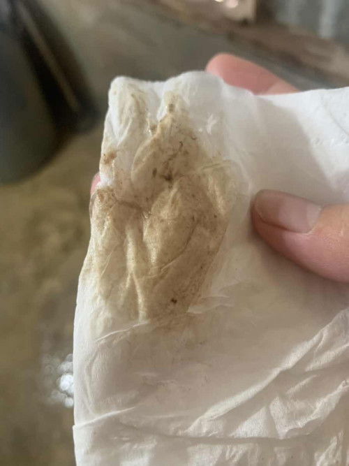 เป็นแบบนี้ออกมาปกติไหมค่ะ