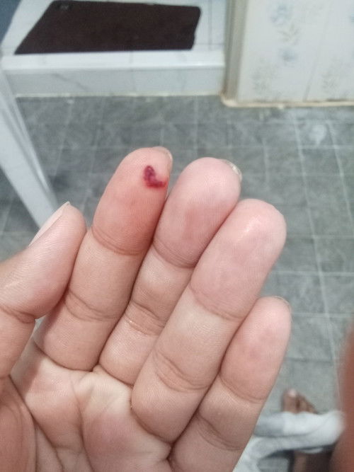 มีมูกแบบนี้ออกมาไปรพ.ได้ยังคะ