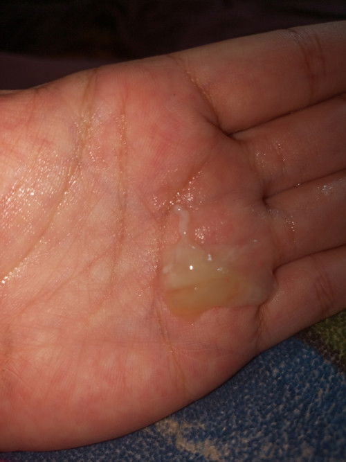 apakah ini mucas plug?