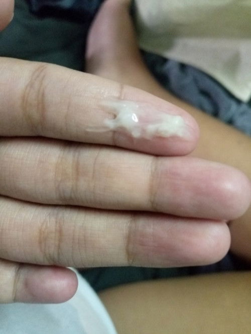 สอบถามแม่ๆใกล้คลอด