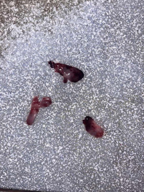 แบบนี้น้องยังอยู่ไหมคะ 5วีค