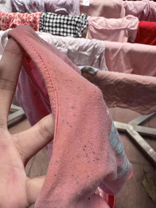 Macam mana nak hilangkan bintik hitam kat baju?