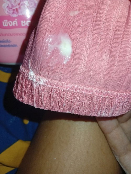 17 วีค กับ 4วัน มีขาวเเบบนี้อันตรายไหมคะ เเละ คันมากๆ กลัวลูกจะเป็นอะไรไป ขอคำตอบหน่อยคะ เเม่ๆ