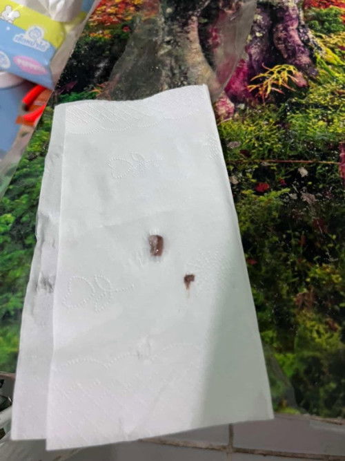 มูกสีแบบนี้อันตรายไหมคะ