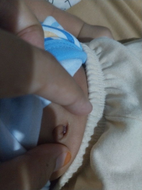 Pusar bayi belum kering