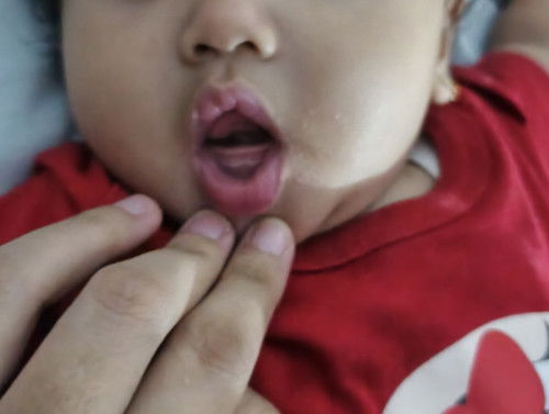 Bayi umur 5bulan 7 hari