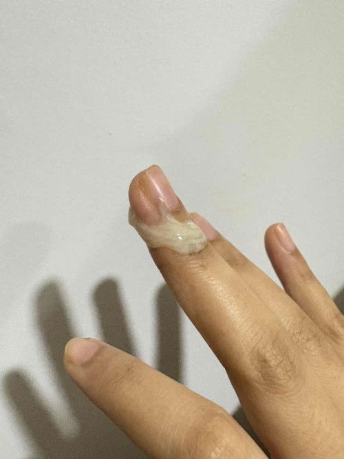 MUCUS PLUG