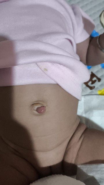 Pusar bayi nb seperti ini