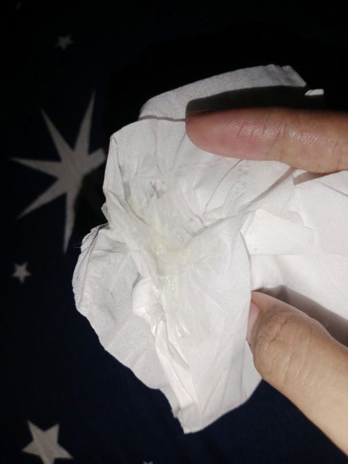 แบบนี้มูกหรือตกขาวคะ