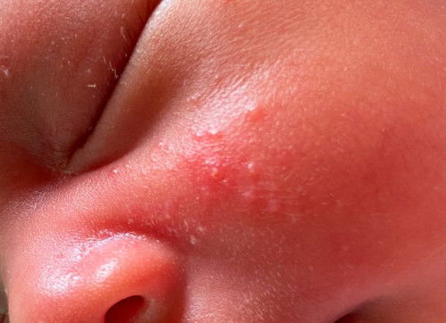 ถามแม่ๆกันหน่อยค่ะ