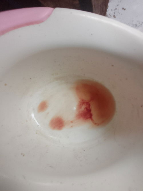 Miscarriage po ba ito?