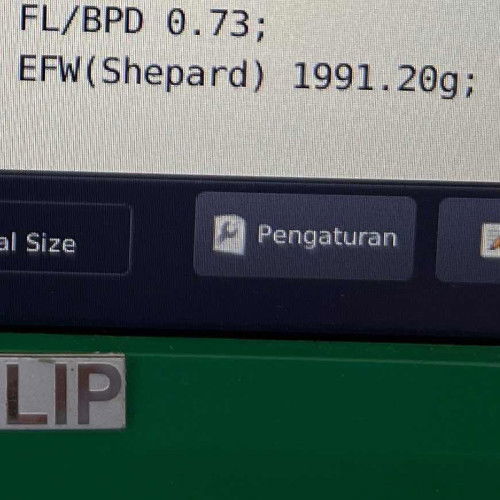 Berat badan janin ketika usg