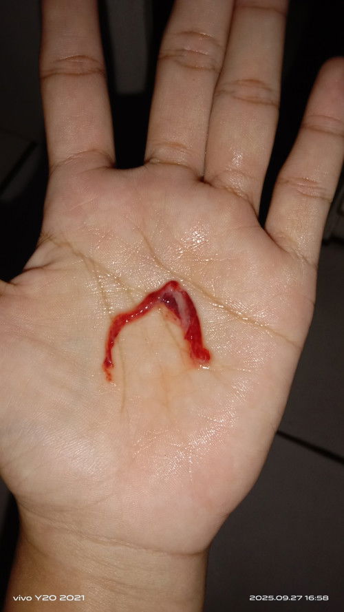 Kluar gumpalan ada putih nya