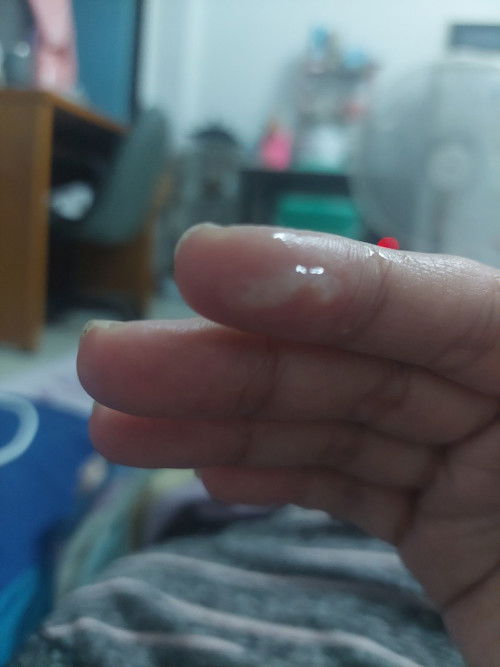 สอบถามคะแม่ๆวันนี้หมอนัดตรวจภายใน 39w