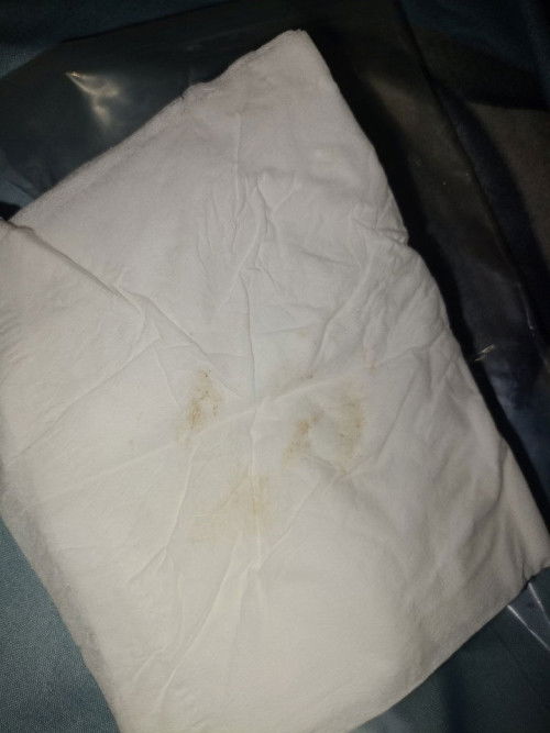 Kehamilan 5minggu 5hari keluar flek coklat bening