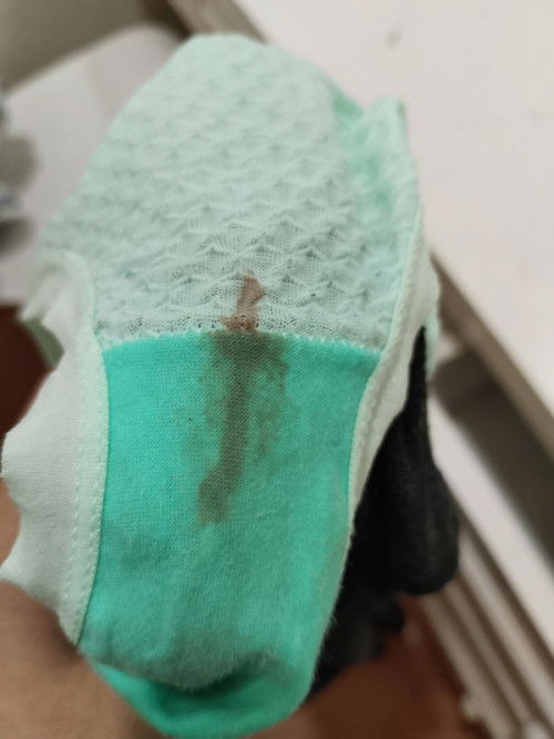 Assalamualaikum semua mau tanya Hamil 5 minggu keluar flek coklat apa tandanya