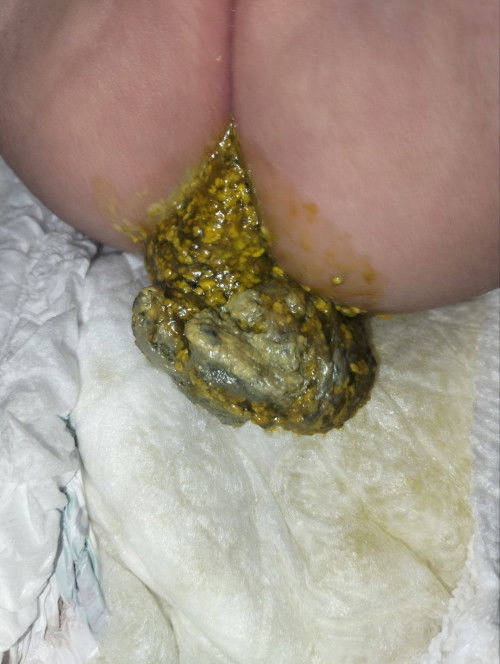 อึสีแบบนี้