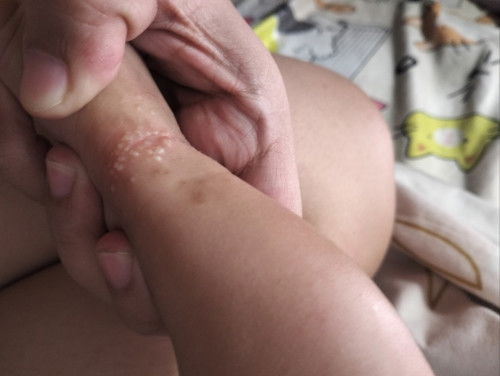 2months old baby tinutubuan po sya ng ganito anu po kaya ito .