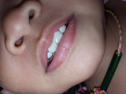 ฟันทำไมเป็นแบบนี้คะ