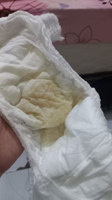 Pipis bayi 11 bulan