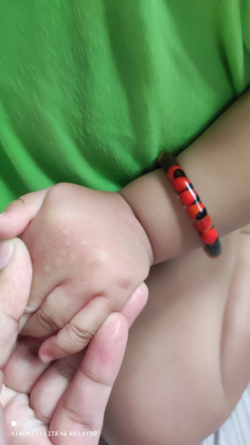 Pantal pantal na maliliit parang kagat ng langgam