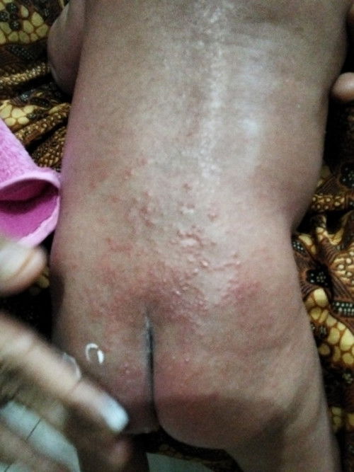 Bun khawatir ini kenapa ya? Ada yg pernah mengalami? Obatnya apa?Sharing plis.. terima kasih