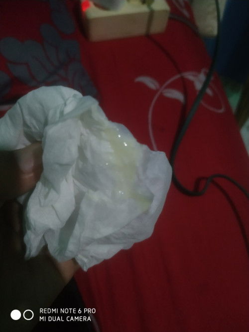 Keluar kek ingus usia kandungan 38week, di bagian mis v, bun mau nanya ini apa ya