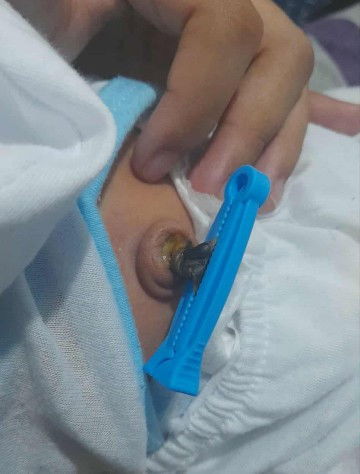 10days old baby