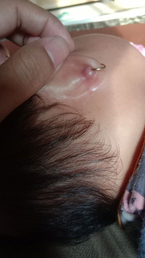 Telinga anak saya kira" kenapa ya bun, apa sering saya pakaikan kaos terus tidur selalu miring