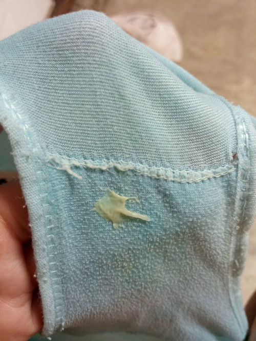yellowish/greenish discharge