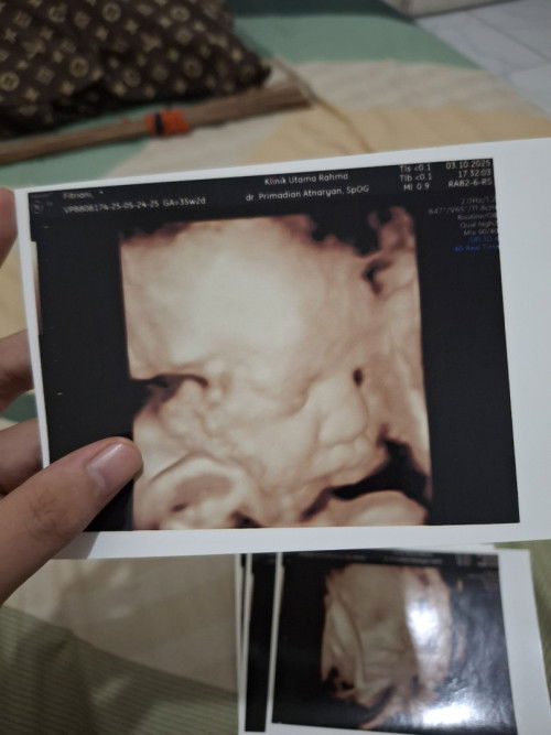 35 week sudah masuk panggul