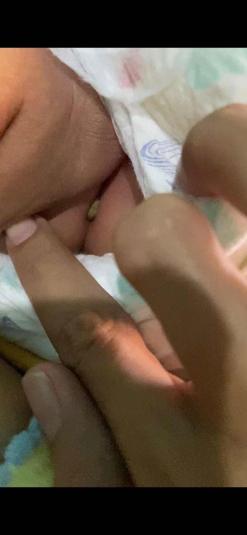 Sembelit pada bayi 3bulan