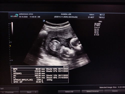 แบบนี้เพศชาย100% มั้ย