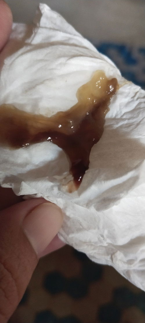 มูกเลือด40+1w