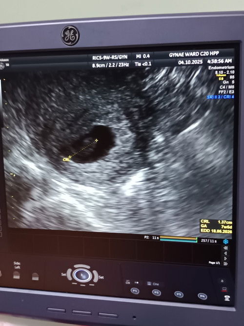 9weeks pregnant.