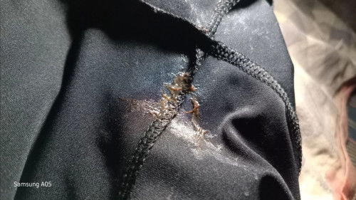 36วิค1วันมีมูกเลือดแบบนี้เป็นอะไรมั้ยคะ