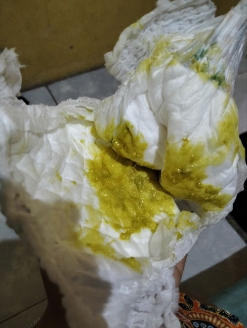 Anak bayi sering pup