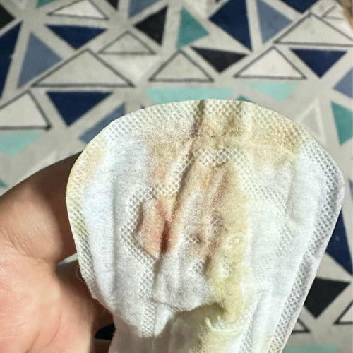 Bleeding Spot Dah Nak Dekat Due Date
