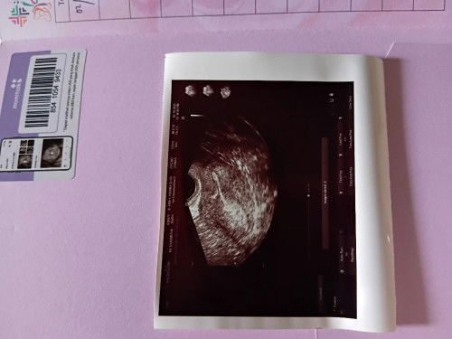 Saran dari pengalaman bunda