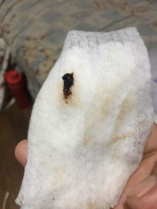 Malapit naba ako manganak neto mga mi?